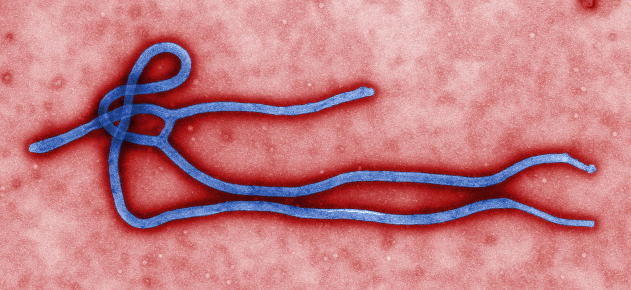 Ebola Anxiety and Mental Terrorism